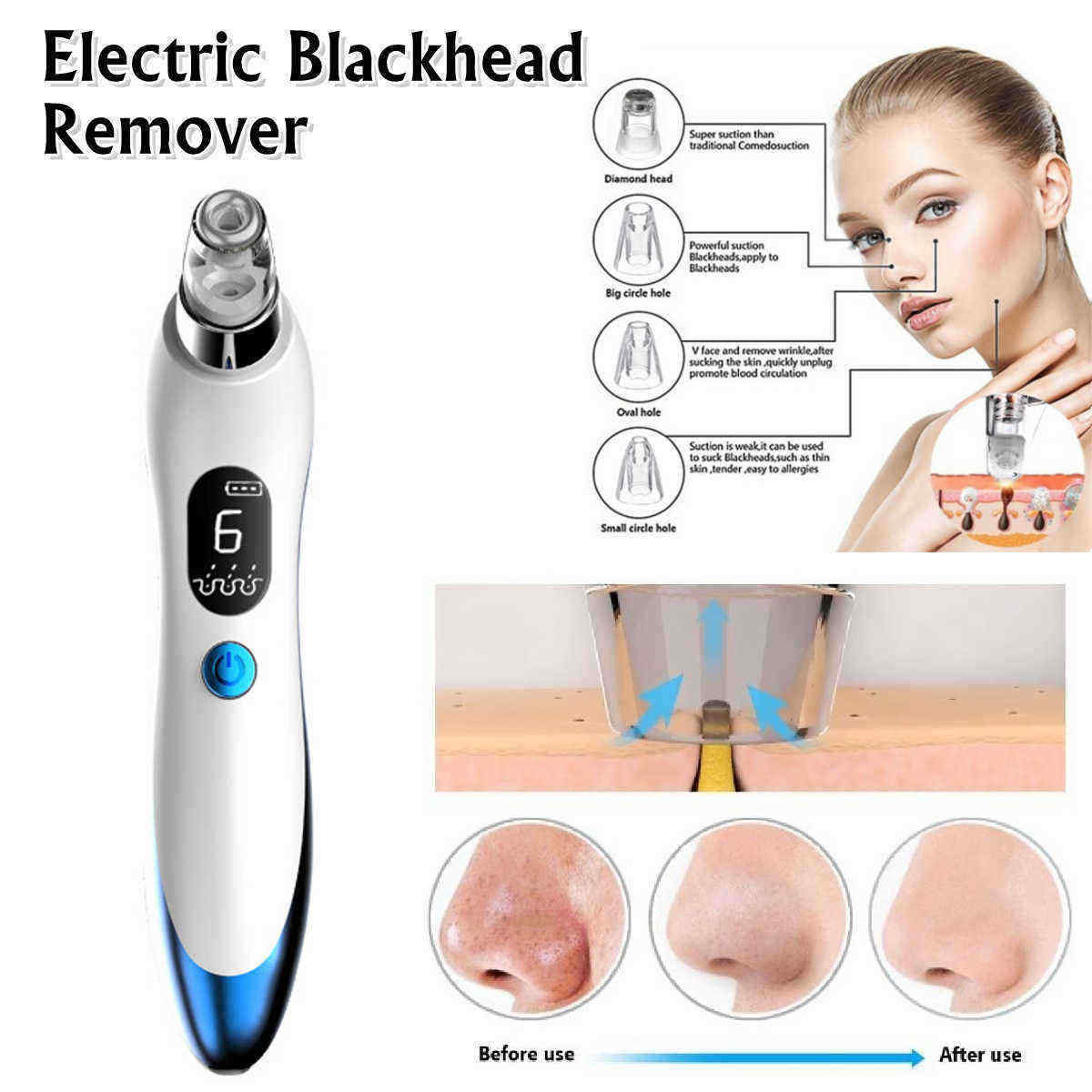 8-In-1-Electric-Blackhead-Remover-Facial-Skin-Pore-Cleaner-Vacuum-Acne-Cleaner-1532528