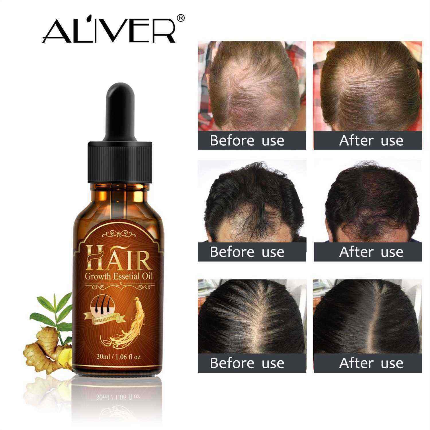 ALIVER-Hair-Care-Nourishing-Growth-And-Hair-Growth-Prevention-Hair-Repair-Growth-Hair-Essence-1560344