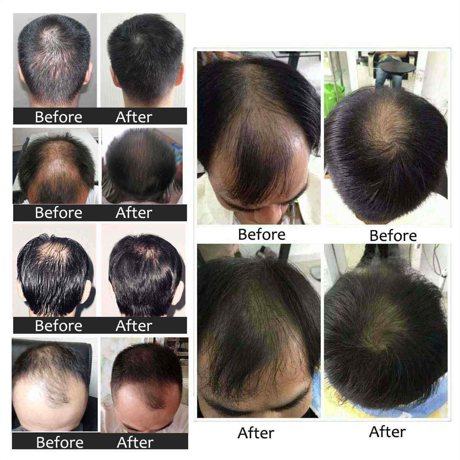 ALIVER-Hair-Care-Nourishing-Growth-And-Hair-Growth-Prevention-Hair-Repair-Growth-Hair-Essence-1560344