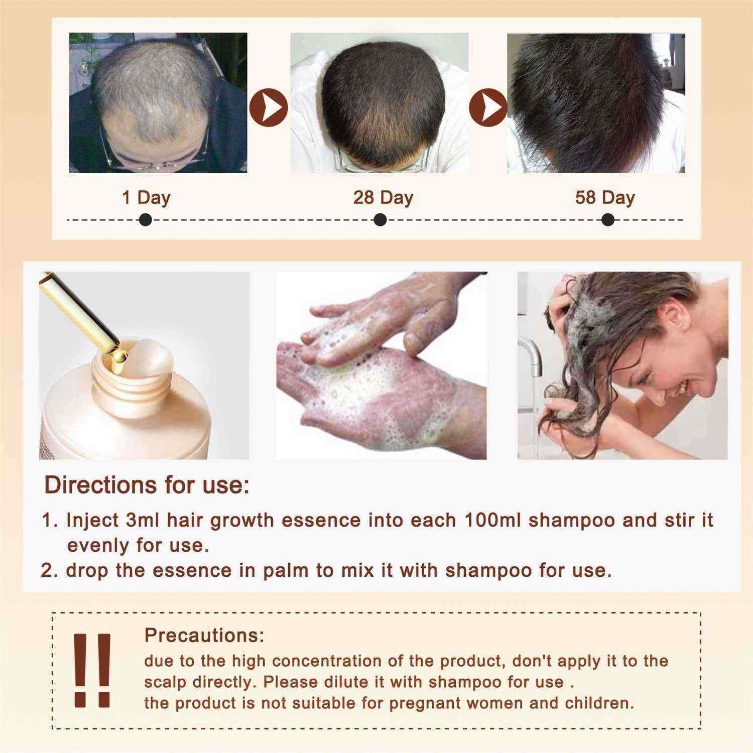 ALIVER-Hair-Care-Nourishing-Growth-And-Hair-Growth-Prevention-Hair-Repair-Growth-Hair-Essence-1560344