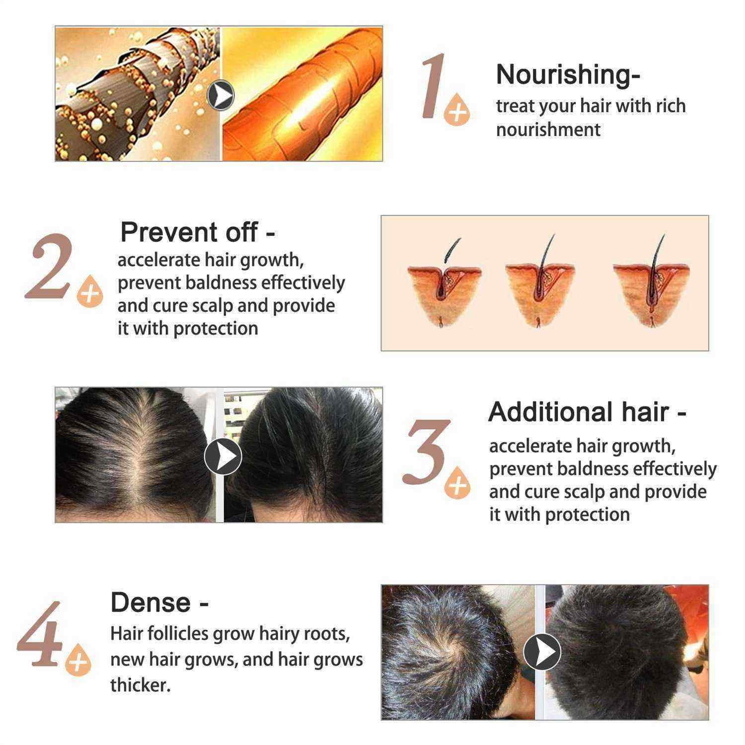 ALIVER-Hair-Care-Nourishing-Growth-And-Hair-Growth-Prevention-Hair-Repair-Growth-Hair-Essence-1560344