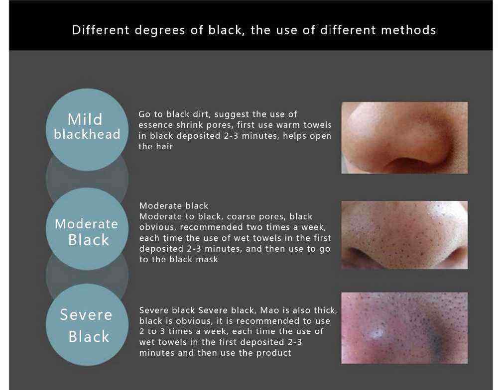 BIOAQUA-Black-Mask-Blackhead--Acne-Treatment-Peel-Off-Face-Masks-1202362