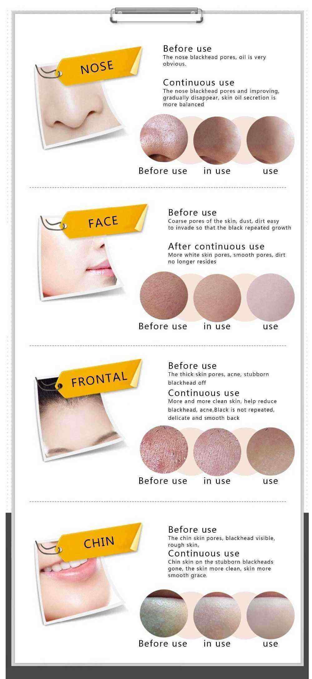 BIOAQUA-Black-Mask-Blackhead--Acne-Treatment-Peel-Off-Face-Masks-1202362