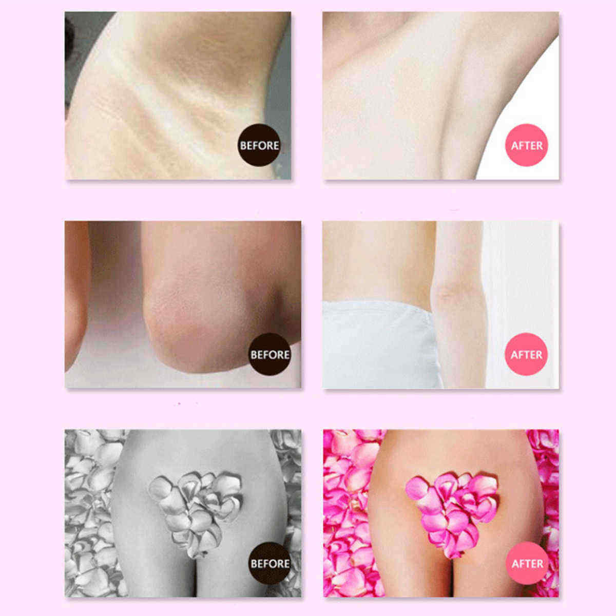 Body-Creams-Underarm-Repair-Cream-Between-Legs-Knees-Private-Part-50g-1282272