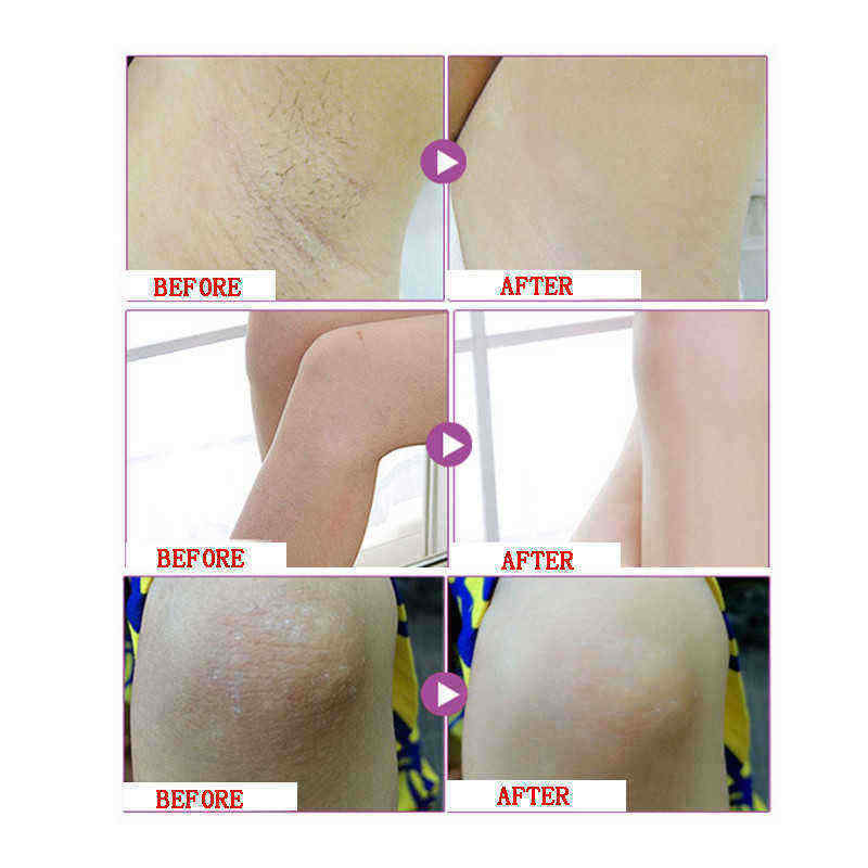 Body-Creams-Underarm-Repair-Cream-Between-Legs-Knees-Private-Part-50g-1282272
