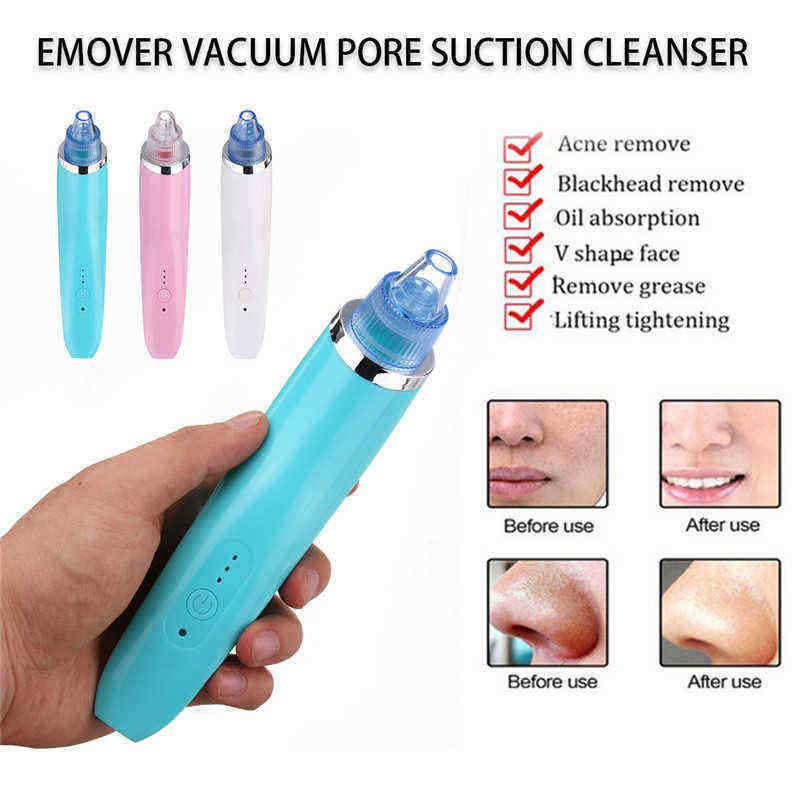 Electric-Blackhead-Suction-Acne-Remover-Vacuum-Pores-Cleanser-Microdermabrasion-Lift-Device-1256705