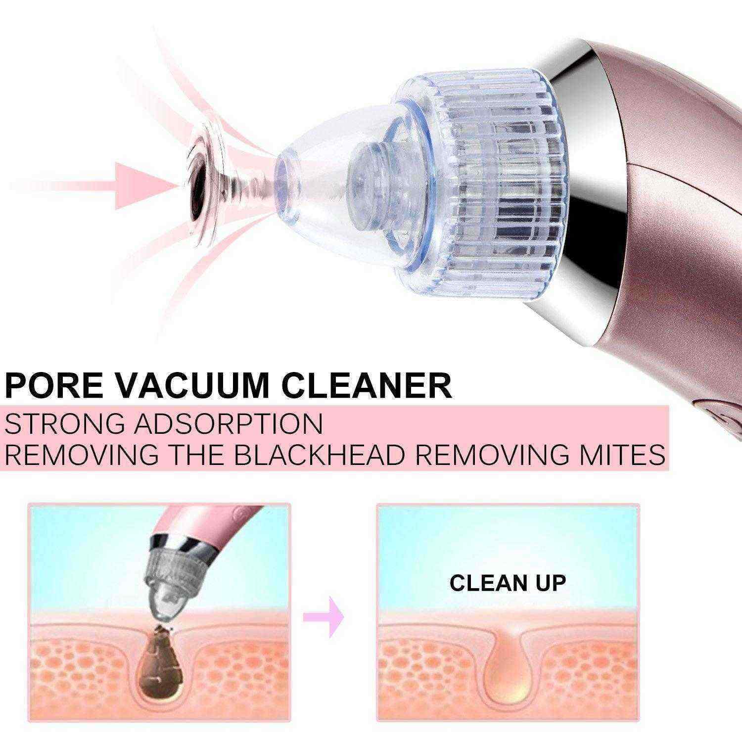 Electric-Blackhead-Suction-Tool-Pore-Cleanser-Vacuum-Microdermabrasion-Facial-Skin-Lift-1148756