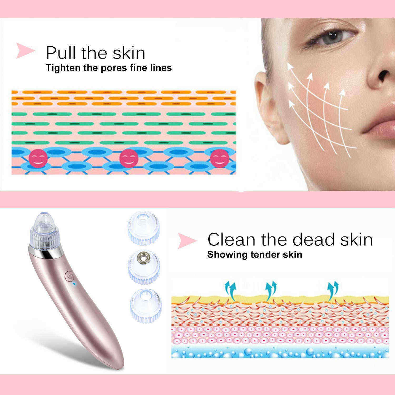 Electric-Blackhead-Suction-Tool-Pore-Cleanser-Vacuum-Microdermabrasion-Facial-Skin-Lift-1148756