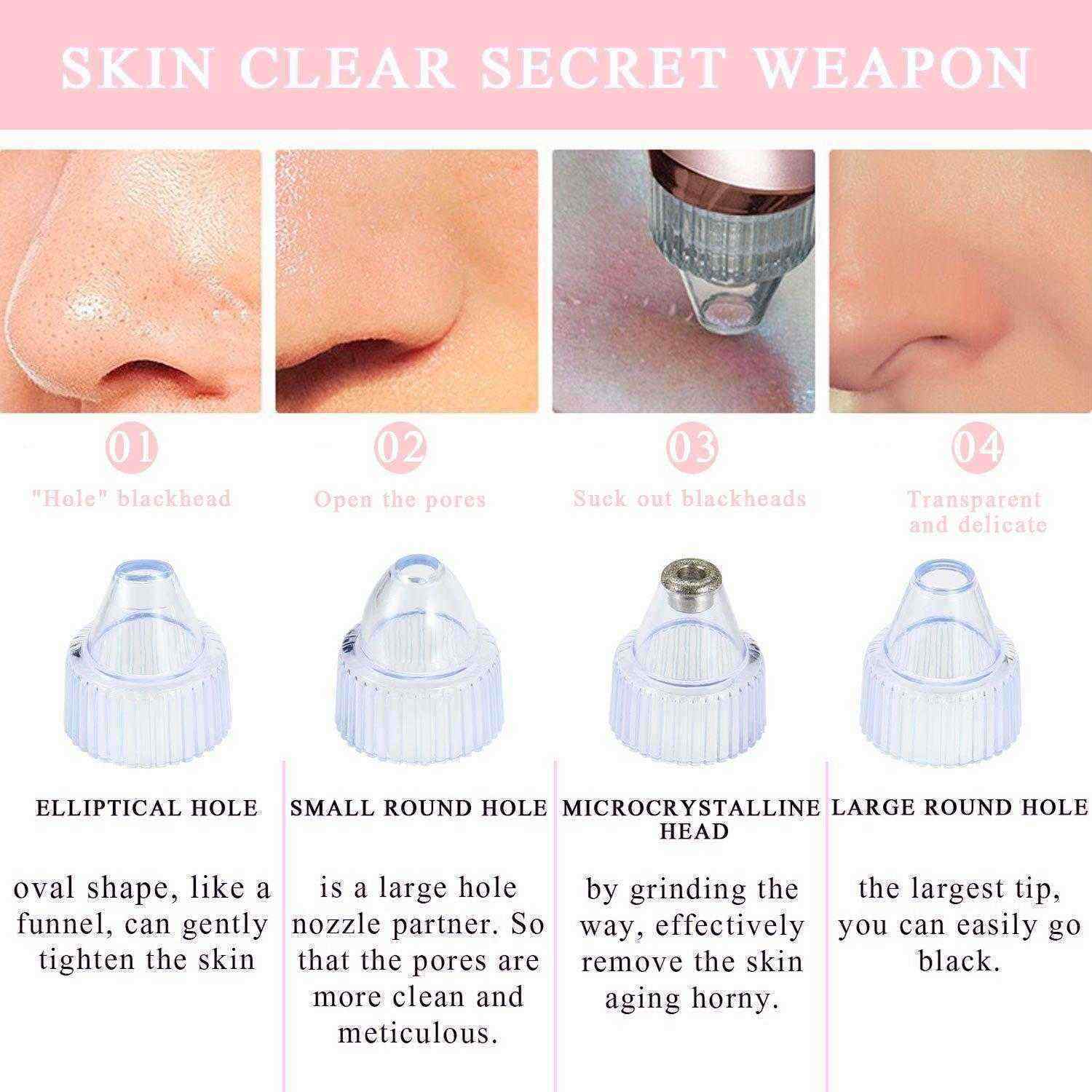 Electric-Blackhead-Suction-Tool-Pore-Cleanser-Vacuum-Microdermabrasion-Facial-Skin-Lift-1148756