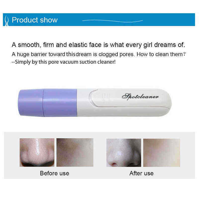 Electric-Facial-Pore-Suction-Spot-Cleaner-Blackhead-Remover-Acne-Pimple-Cleanser-Lifting-Firming-Ski-1223737