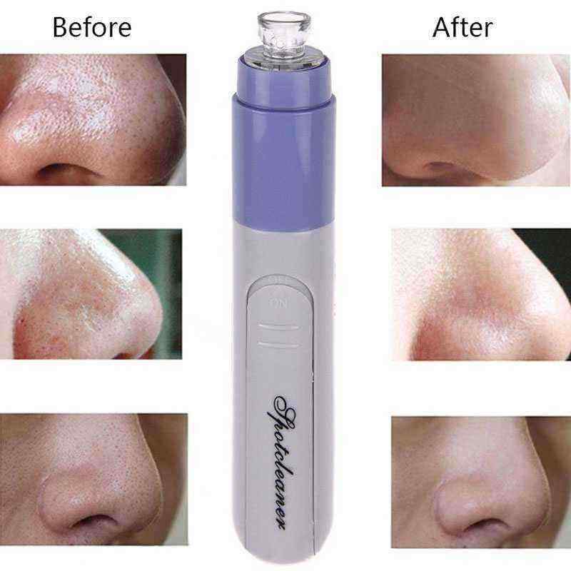 Electric-Facial-Pore-Suction-Spot-Cleaner-Blackhead-Remover-Acne-Pimple-Cleanser-Lifting-Firming-Ski-1223737