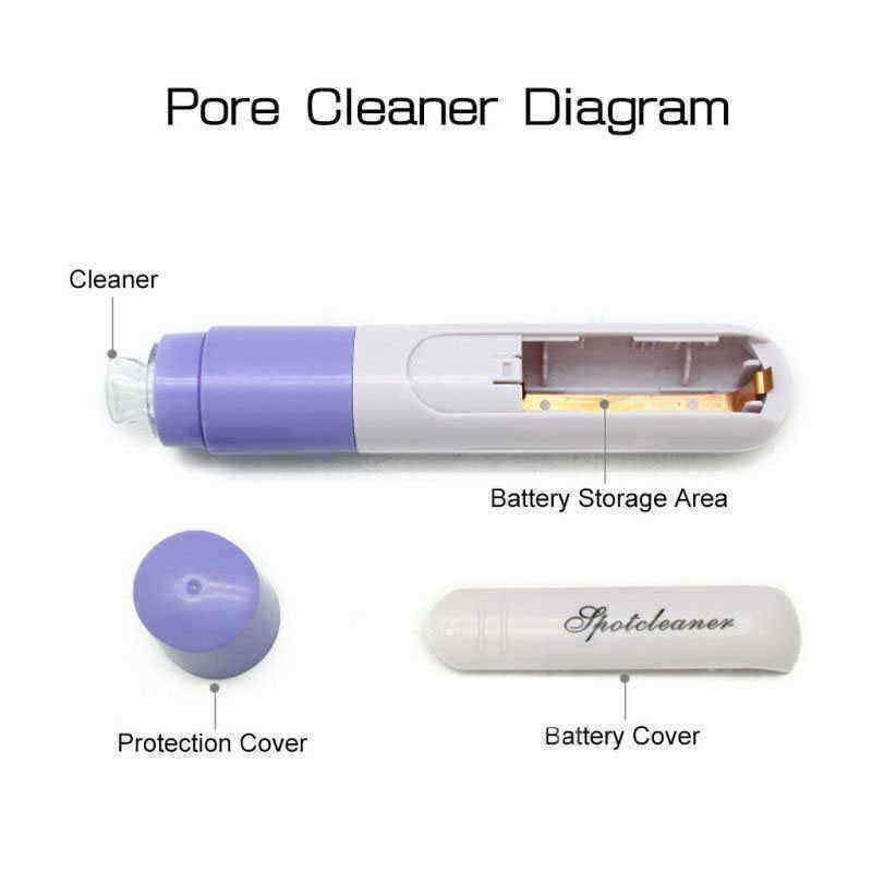 Electric-Facial-Pore-Suction-Spot-Cleaner-Blackhead-Remover-Acne-Pimple-Cleanser-Lifting-Firming-Ski-1223737