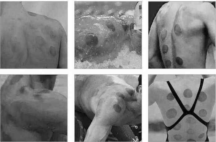 Facial-Cupping-Massage-Anti-Ageing-Lift-Skin-Reduce-Spot-Wrinkle-Silicone-Vacuum-Cup-Body-1169599