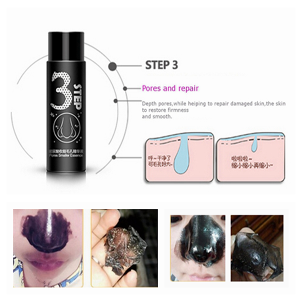 Hyaluronic-Blackhead-Removal-Mask-Face-Nose-Acne-Peeling-Off-Carbon-Masks-Set-1056235