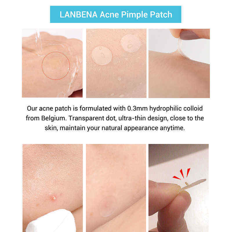 LANBENA-Tea-Tree-Daily-Acne-Stickers--Night-acne-Stickers-Fade-Blackhead-Acne-Remover-1538280