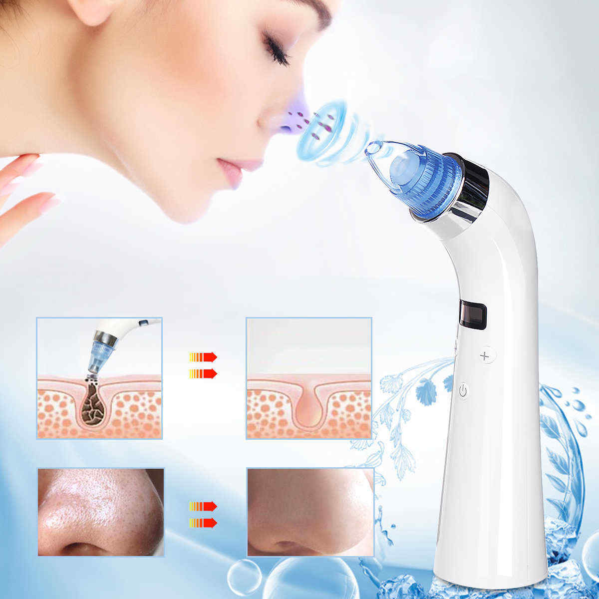 LCD-Display-USB-Electric-Blackhead-Remover-Microdermabrasion-Vacuum-Suction-Pore-Cleaner-Machine-1335491