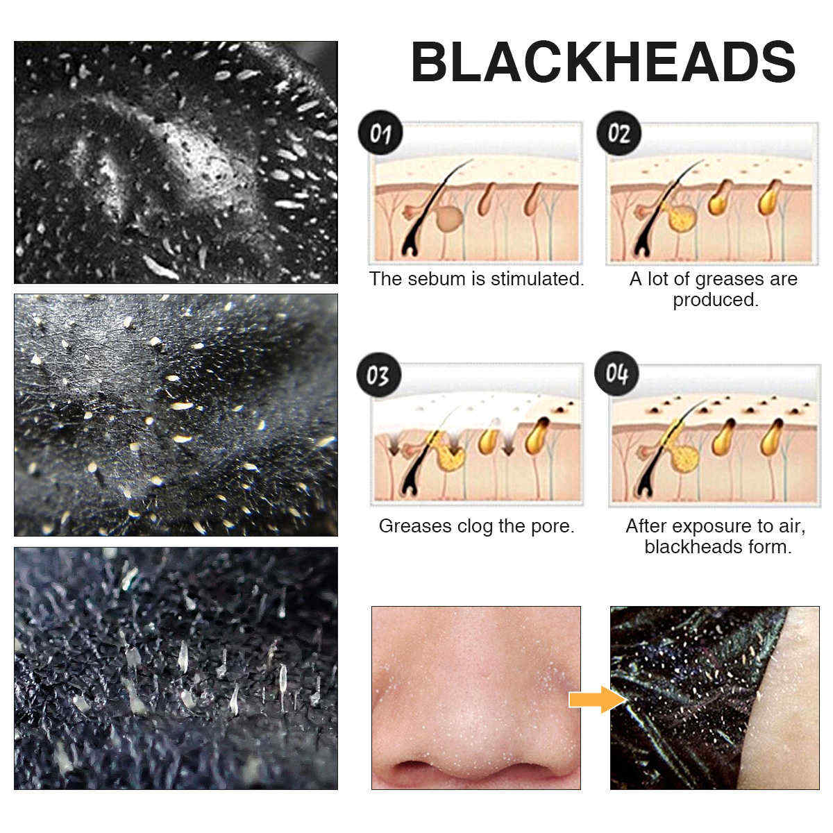 Lucky-Fine-Blackhead-Remove-Peel-Mask-Deep-Cleaning-Purifying-Tearing-Nose-Black-Mask-1396130
