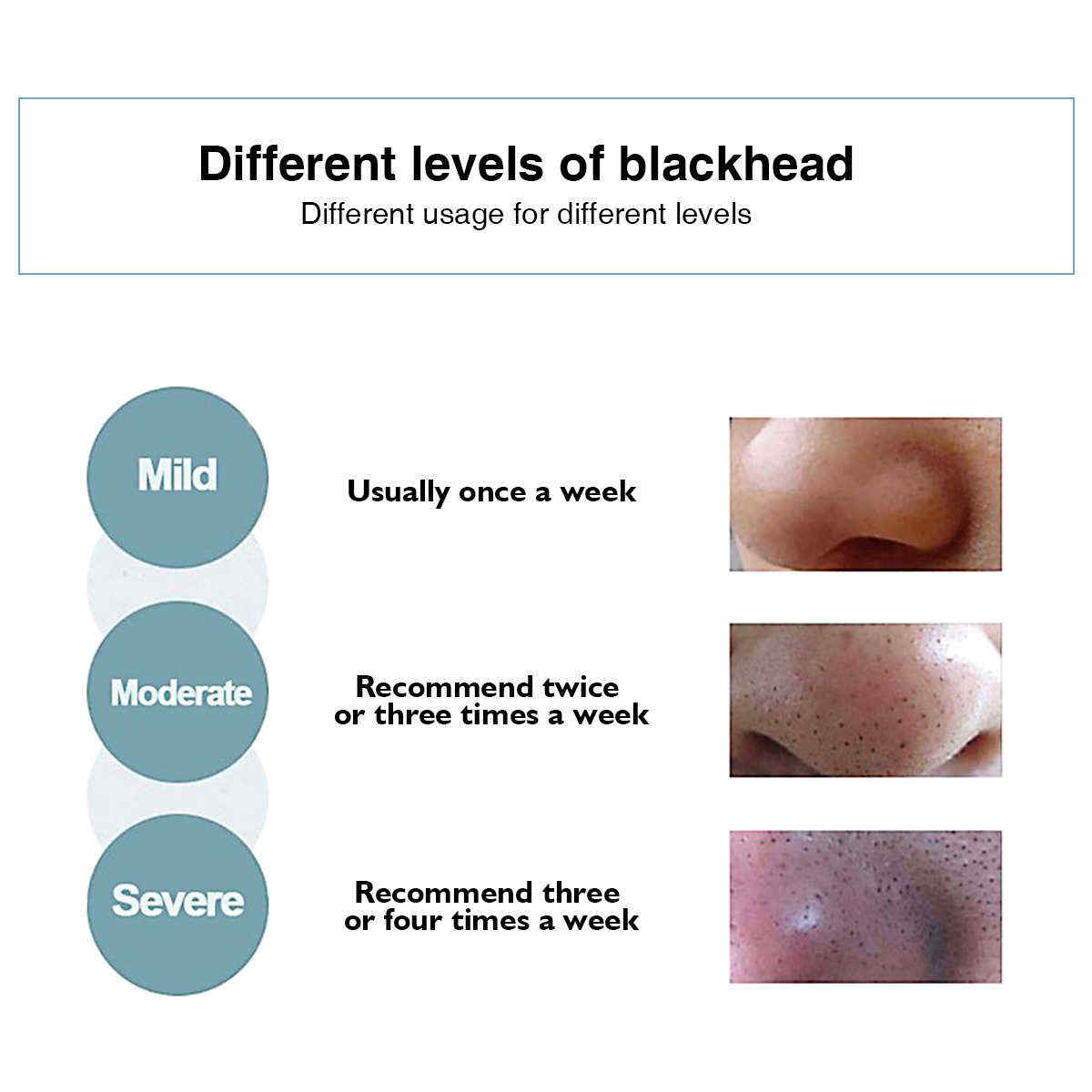 Lucky-Fine-Blackhead-Remove-Peel-Mask-Deep-Cleaning-Purifying-Tearing-Nose-Black-Mask-1396130