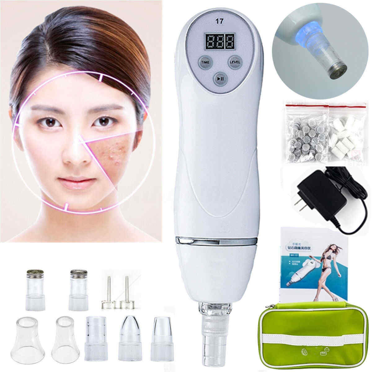 Micro-carving-And-Polishing-Instrument-Rejuvenation-Electric-Blackhead-Suction-1104369