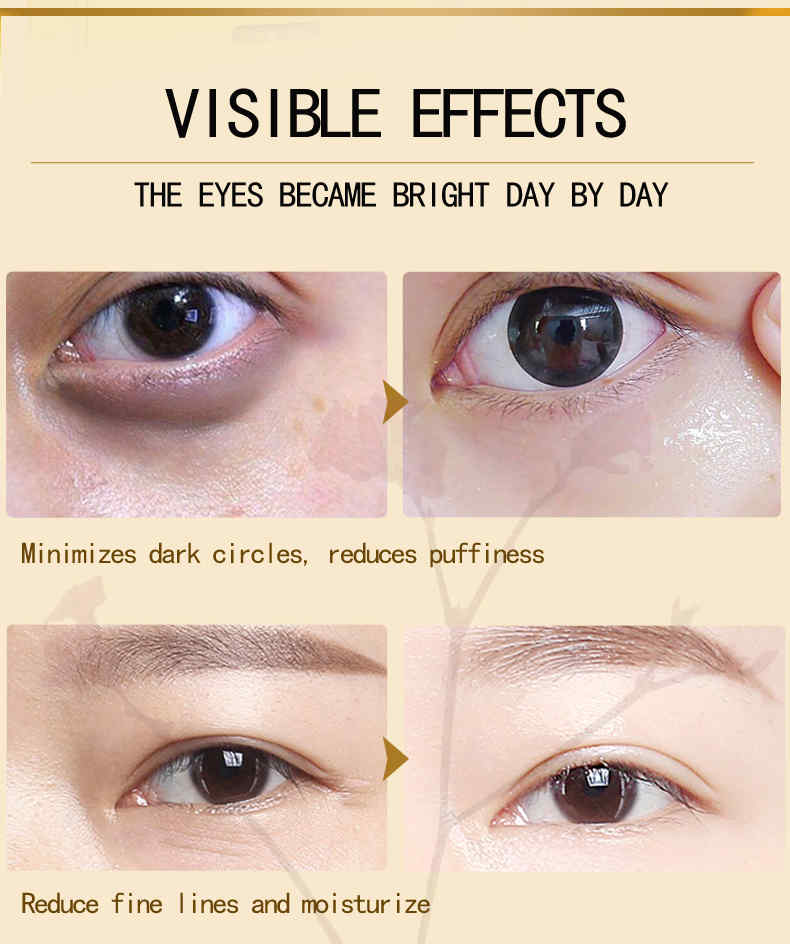 OEDO-Hyaluronic-Acid-Ginseng-Eye-Cream-Remover-Dark-Circles-Eye-Essence-Against-Puffiness-Serum-1323206
