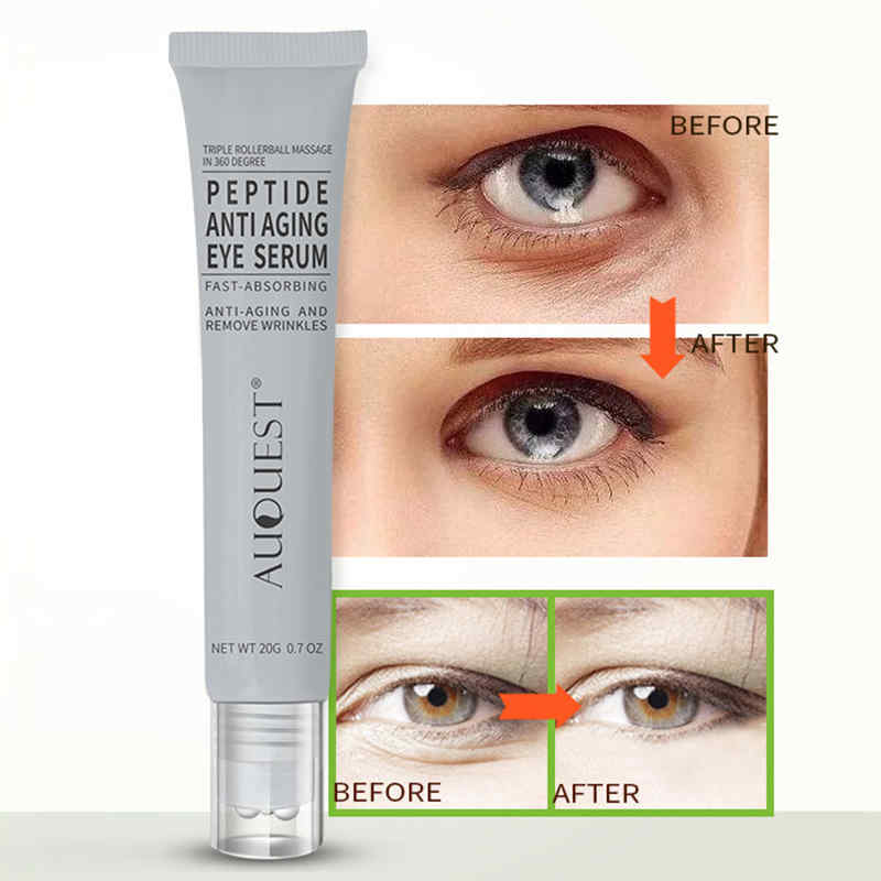 Polypeptide-Eye-Cream-Anti-Wrinkle-Remove-Dark-Circle-Eye-Bag-Anti-Puffiness-Roller-Eye-Skin-Care-1361850