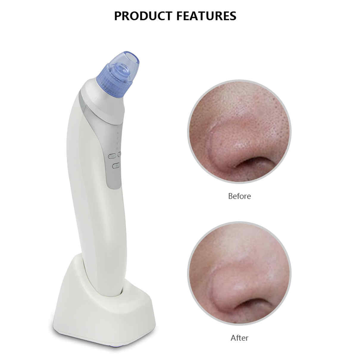 Rechargeable-Blackhead-Suction-Tool-Acne-Remover-Microdermabras-Machine-Pore-Cleansing-Tighten-1128064