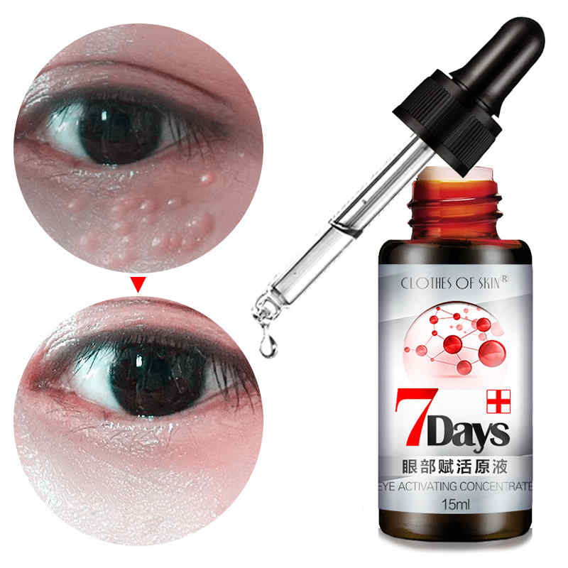 Revitalizing-Eye-Essence-Liquid-Fade-Dark-Circle-Eye-Bag-Remove-Fat-Granule-Essence-Face-1376604