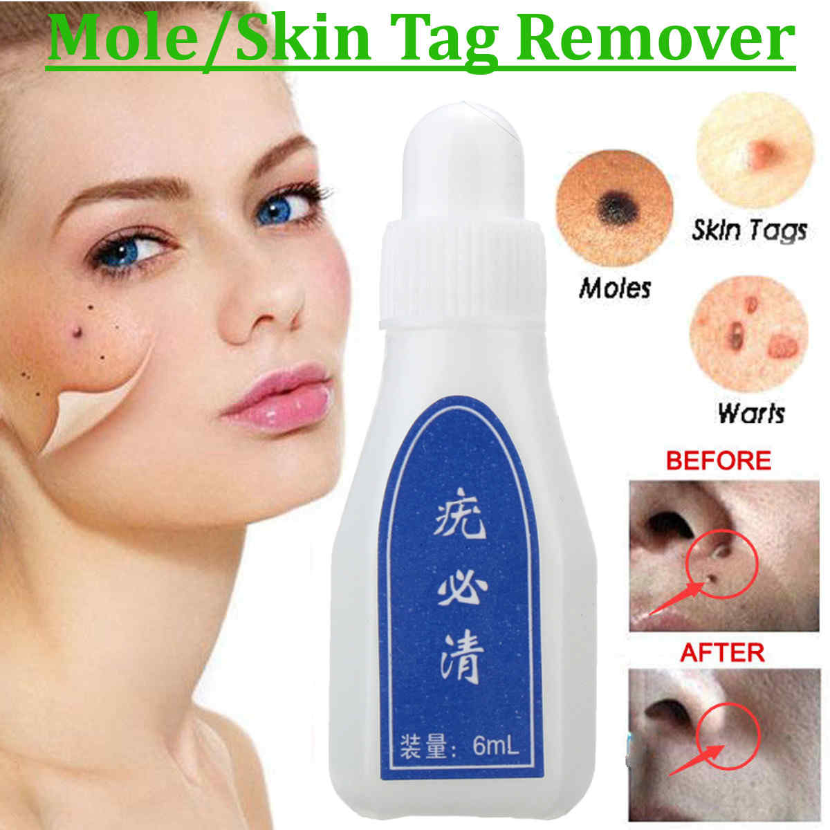 Skin-Wart-Removal-Liquid-Skin-Tag-Mole-amp-Genital-Wart-Remover-12-Hours-Kill-Skin-Care-1370772