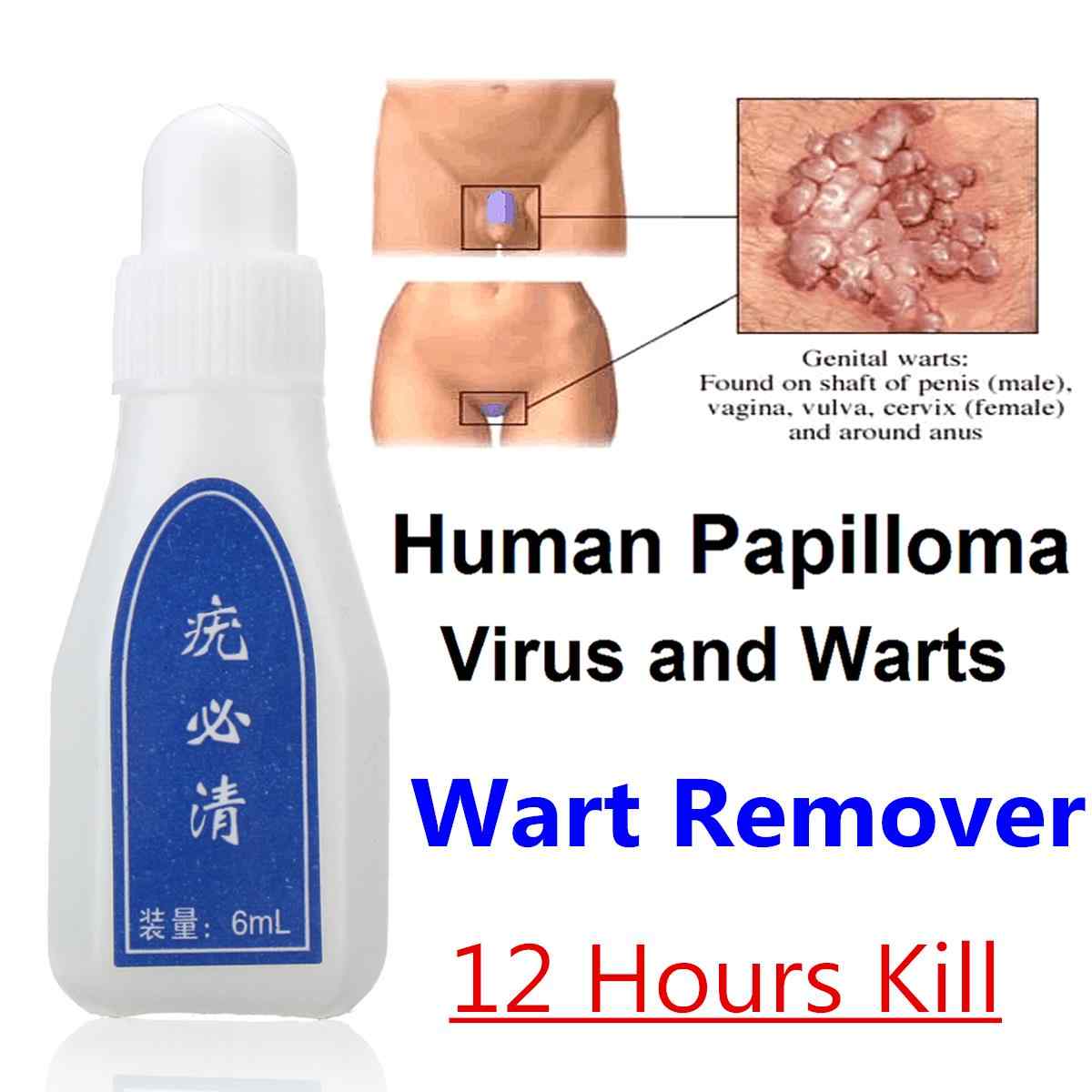 Skin-Wart-Removal-Liquid-Skin-Tag-Mole-amp-Genital-Wart-Remover-12-Hours-Kill-Skin-Care-1370772