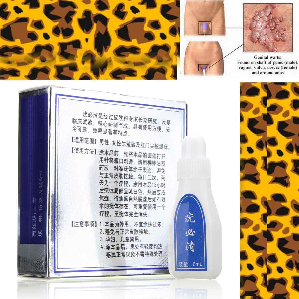 Skin-Wart-Removal-Liquid-Skin-Tag-Mole-amp-Genital-Wart-Remover-12-Hours-Kill-Skin-Care-1370772
