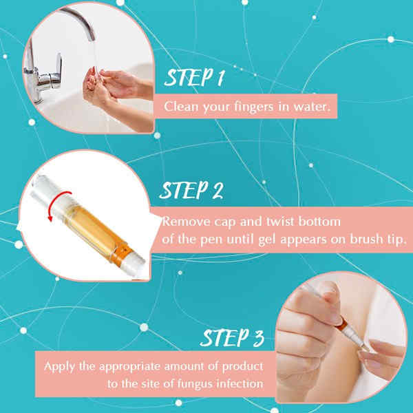 Skymore-Toenail-Fungus-Treatment-Fungal-Nail-Gel-with-Nail-File-Toenails-amp-Fingernails-Solution-1292874