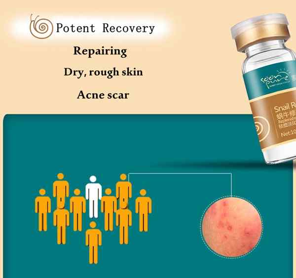 Soon-Pure-Snail-Repairing-Moisturizing-Solution-Original-Liquid-970785