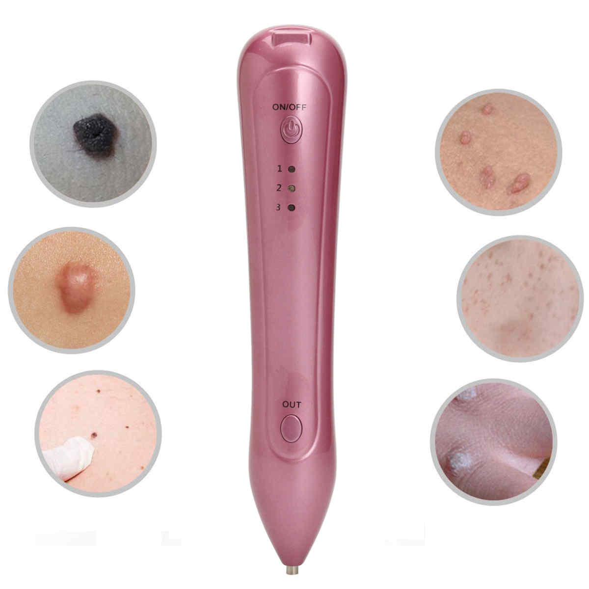 Spot-Mole-Remover-Spot-Remove-freckle-Removal-Beauty-Pen-Skin-Care-Machine-1165897