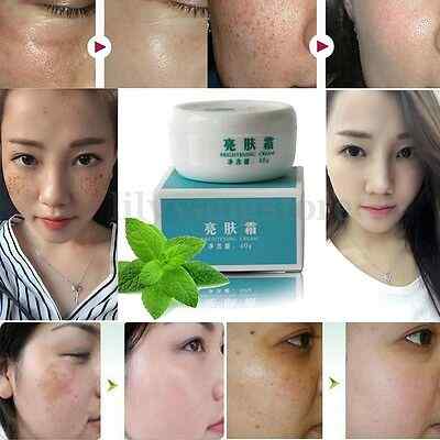 Suction-Spot-Cream-Face-Care-Whitening-Remove-Freckle-Dark-Spots-Scar-Whitening-Cream-1149757