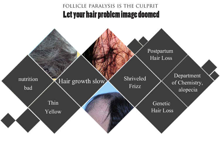 TYJR-Herbal-Fast-Hair-Growth-Serum-Essence-Women-Anti-Hair-Loss-Liquid-30g-Repairing-Care-1233466