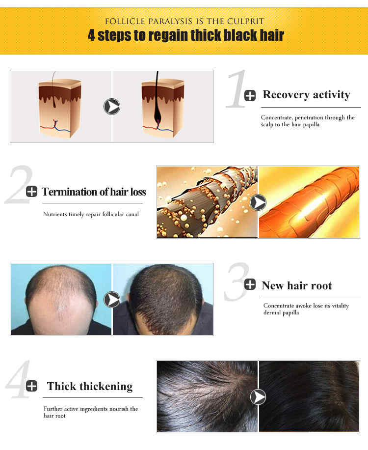 TYJR-Herbal-Fast-Hair-Growth-Serum-Essence-Women-Anti-Hair-Loss-Liquid-30g-Repairing-Care-1233466