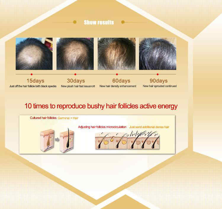 TYJR-Herbal-Fast-Hair-Growth-Serum-Essence-Women-Anti-Hair-Loss-Liquid-30g-Repairing-Care-1233466