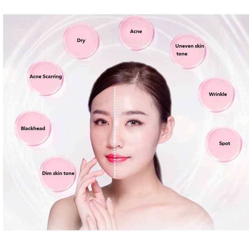 USB-Multifunction-Electric-Skin-Rejuvenation-Instrument-Moisturizing-Cleaner-Beauty-Machine-1348868