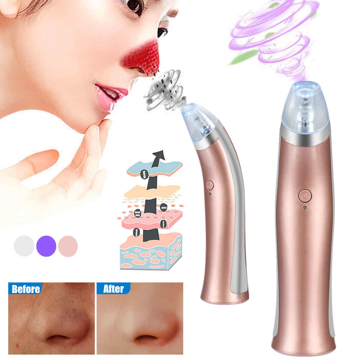 Vacuum-Blackheads-Remover-Dirt-Suction-Tool-Facial-Pores-Cleansing-Machine-Rechargeable-Tighten-Lift-1242222