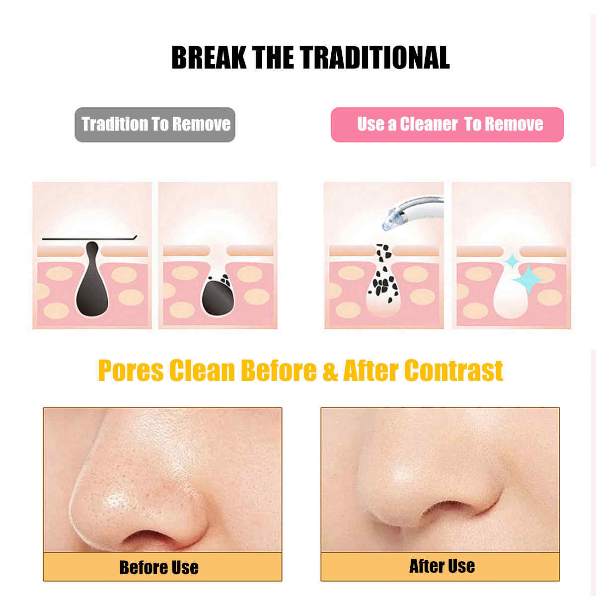 Vacuum-Blackheads-Remover-Dirt-Suction-Tool-Facial-Pores-Cleansing-Machine-Rechargeable-Tighten-Lift-1242222