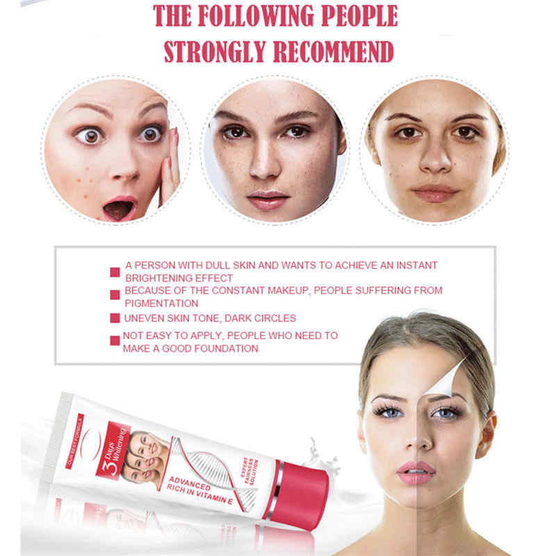 Vitamin-E-Face-Whitening-Cream-for-Dark-Skin-Bleaching-Moisturizing-Lotion-25g-1357878