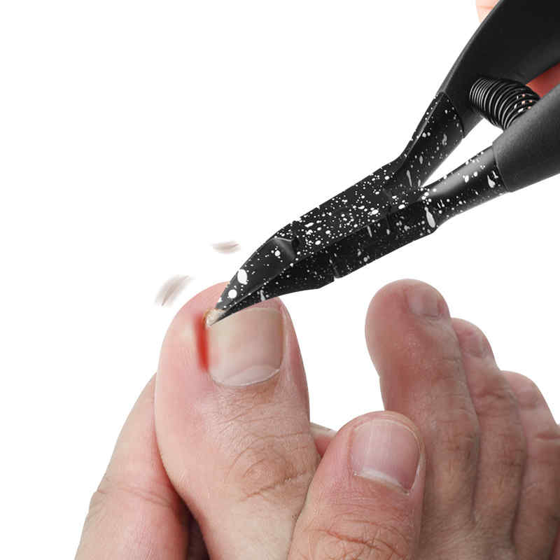 YFMreg-Ingrown-Toenails-Clipper-Pro-Toenails-Fingernails-Cutter-Manicure-Nail-Scissors-1448487