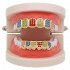 Punk Geometric Colorful Rhinestone Braces Clown Grillz Diamond Gold Braces Teeth Jewelry