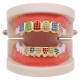 Punk Geometric Colorful Rhinestone Braces Clown Grillz Diamond Gold Braces Teeth Jewelry