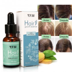 Y.F.M@20ml Hair Growth Essence Prevent Hair Loss Promote Hair Growth Essence Hair Scalp Treatments Serum