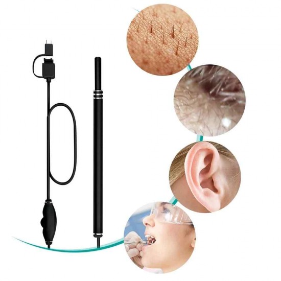 Y.F.M®3 In 1 Ear Cleaning Endo-Scope HD Visual Ear Spoon Multifunctional Earpick Ear Care Health
