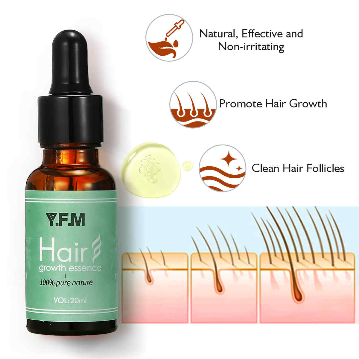 YFM20ml-Hair-Growth-Essence-Prevent-Hair-Loss-Promote-Hair-Growth-Essence-Hair-Scalp-Treatments-Seru-1382141